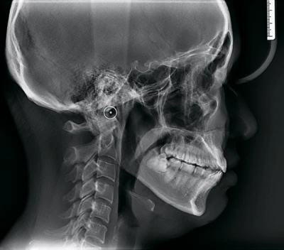 Inline Image 1