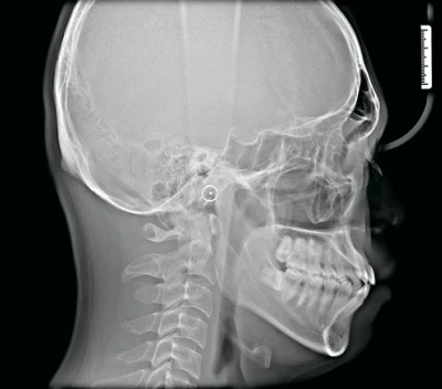 Inline Image 2
